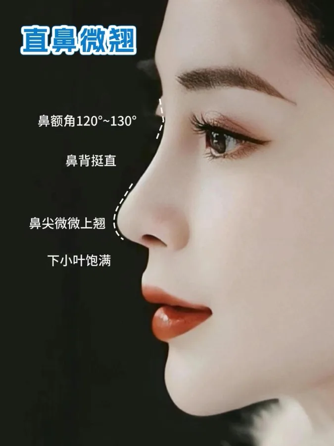 Historical facial lifting and Baby Face case 05