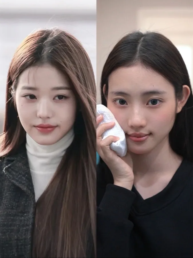 Historical facial lifting and Baby Face case 06