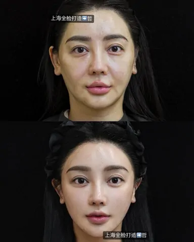 Historical Baby Face case archive image 23