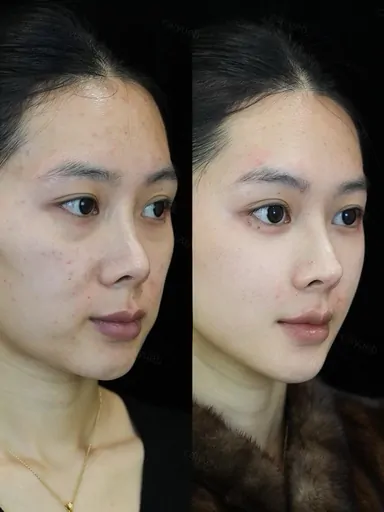 Historical Baby Face case archive image 34