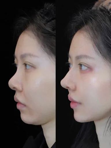 Historical Baby Face case archive image 46