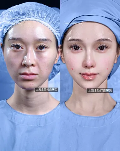 Historical Baby Face case archive image 44