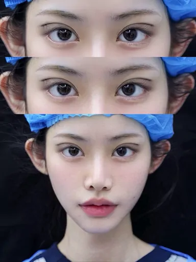 Historical Baby Face case archive image 52