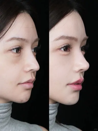 Historical Baby Face case archive image 28