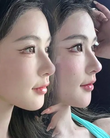 Historical Baby Face case archive image 39