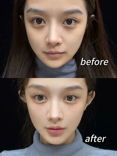 Historical Baby Face case archive image 11