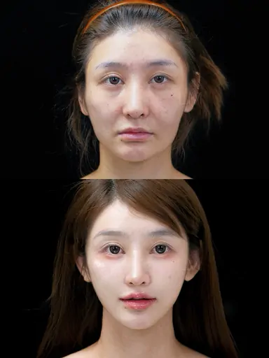 Historical Baby Face case archive image 16